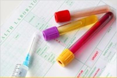 Chronic_kidney_disease_is_detected_through_blood_and_urine_tests